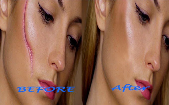 image slot