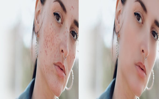 image slot